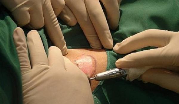 علماء يؤكدون إمكانية نقل أعضاء حيوانية للبشر