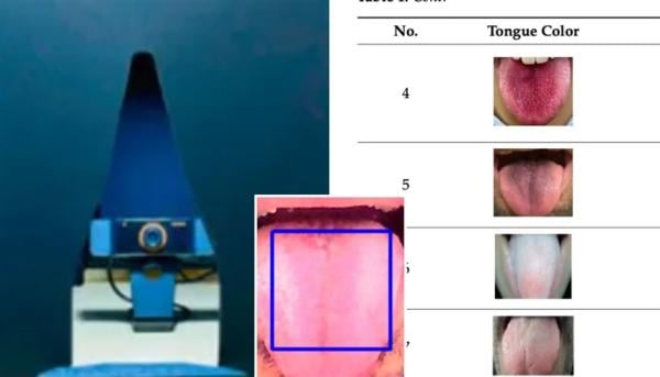 خوارزمية ذكاء اصطناعي تكشف الأمراض عبر لون اللسان بدقة عالية