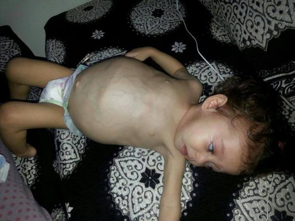 بعد قراءته لنداء المساعدة على موقع أخبارنا ، وزير الصحة يصدر تعليماته بالتكفل بحالة الطفلة فوزية اليثي