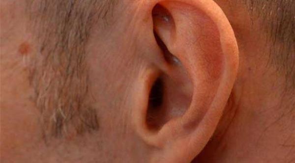 ضغط الأذن المستمر قد يؤدي إلى فقدان السمع