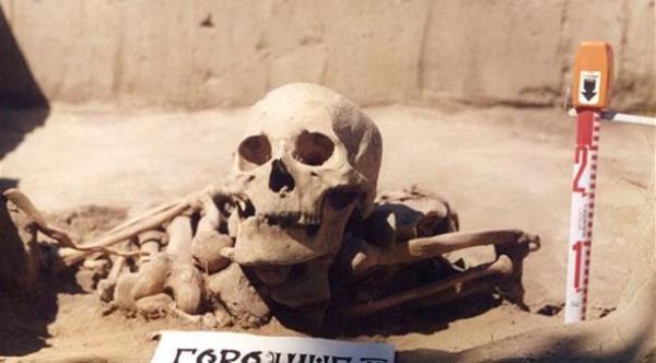 العثور على أقدم حالة إصابة بالسرطان في التاريخ