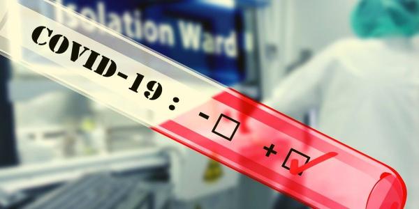 8 جهات تسجل حالات جديدة في آخر 24 ساعة وهذه تفاصيل التوزيع الجغرافي