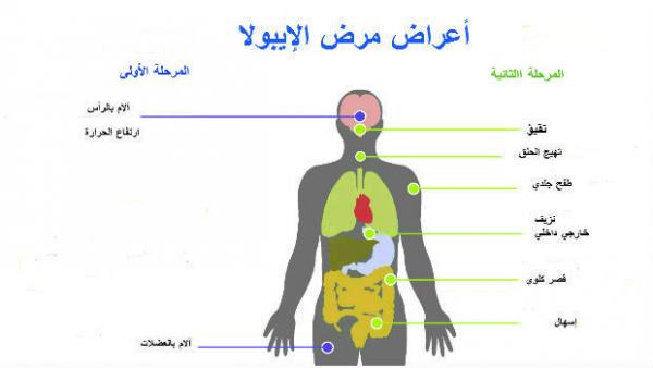 أعراض فيروس &quot;ايبولا&quot; و إرشادات للوقاية منه