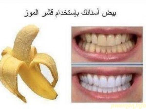 أسرع طريقة لتبيض الأسنان بأستخدام قشر الموز