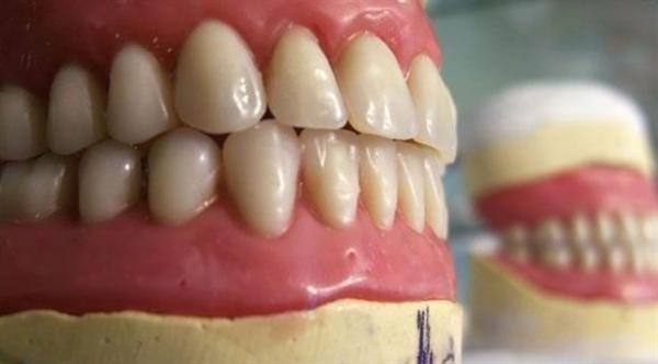 كيفية العناية السليمة بطقم الأسنان