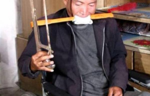 صيني يبتر ساقه بمنشار بسبب عدم امتلاكه تكاليف العملية