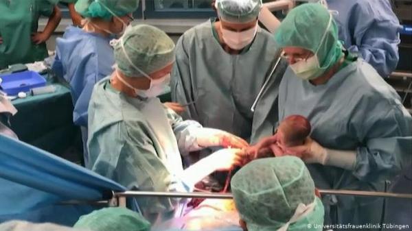 حدث طبي نادر في ألمانيا ـ نجاح عملية زراعة أرحام قابلة للإنجاب