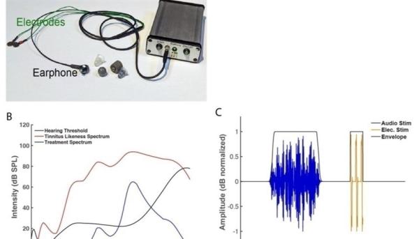 تطوير جهاز ثوري لعلاج طنين الأذن بواسطة التحفيز الكهربي