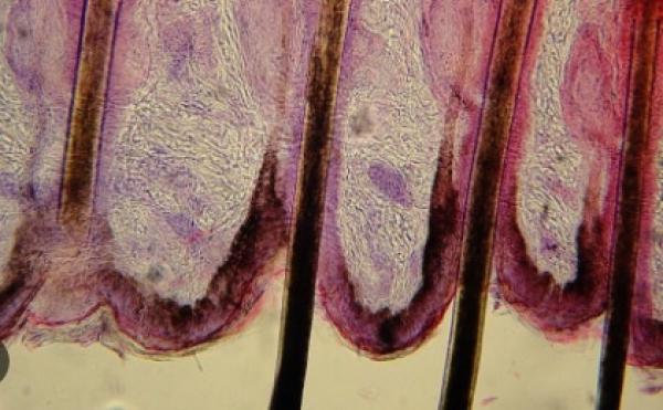 علماء ينتجون بصيلات شعر بتقنية "ثلاثية الأبعاد" تحل مشكلة الصلع
