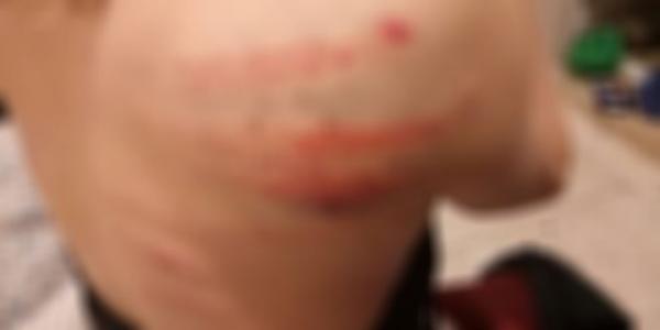 اعتداء خطير على طالبة بالحي الجامعي بفاس و المتهمون 4