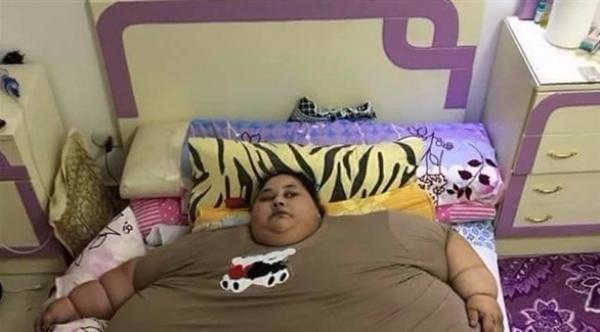 مصرية تزن نصف طن تبحث عن الشفاء في الهند