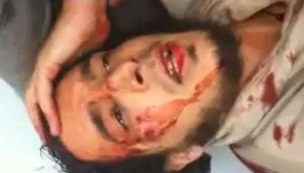 إصابة خطيرة لسجين سلفي بسجن سلا و استمرار التوتر في عدة سجون بالمغرب