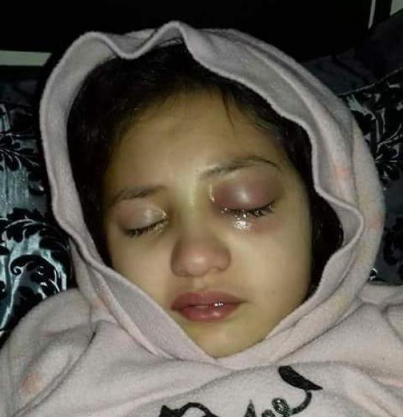 رسميا...ظهور نتائج التقرير الطبي في قضية "هبة والمعلمة" وصراع جديد يلوح في الأفق